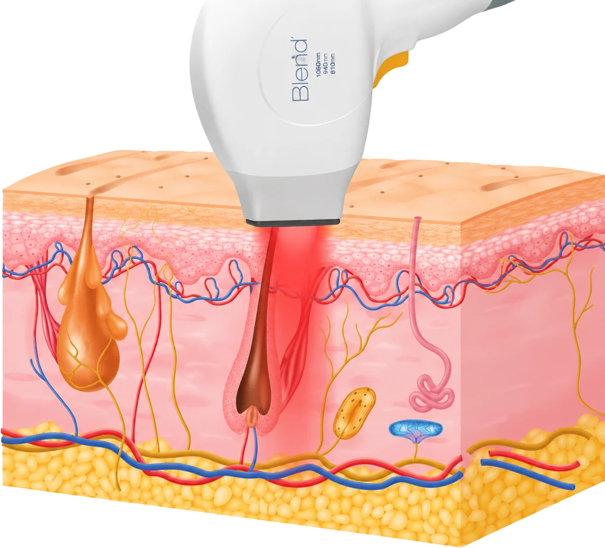 primelase_Diodenlaser_Blend_Handstück
